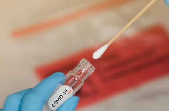 კორონავირუსის 13 დეკემბრის სტატისტიკა