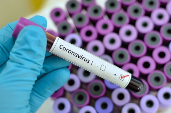  იმერეთში ვირუსით ინფიცირების180 ახალი შემთხვევა გამოვლინდა