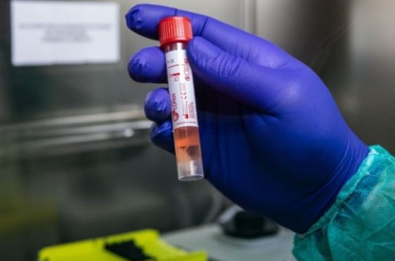 საქართველოში გამოვლინდა ვირუსით ინფიცირების 1219 შემთხვევა, იმერეთში - 61