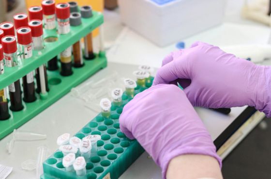 4 იანვარი: საქართველოში კორონავირუსით კიდევ 594 ადამიანი დაინფიცირდა