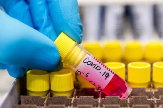 მსოფლიოში კორონავირუსით ინფიცირების საერთო რაოდენობა 190 მილიონზე მეტია