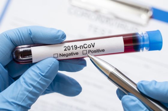 კორონავირუსის 23 ოქტომბრის სტატისტიკა