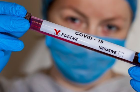 კორონავირუსის 24 დეკემბრის სტატისტიკა 