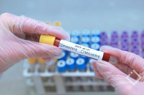 კორონავირუსის 22 ნოემბრის სტატისტიკა