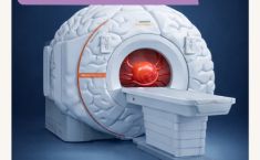 თავის ტვინის ანევრიზმის სკრინინგი ქუთაისში